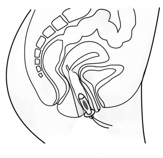 Promed IT-6 com sonda vaginal